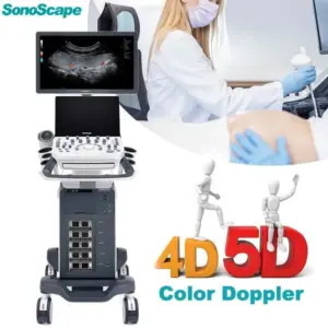 sonoscape p1541b7c0e8 e360 4eff aa3f 9ea654098b31